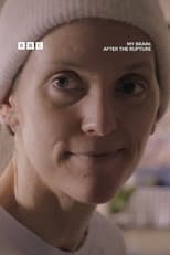 Poster for My Brain: After the Rupture