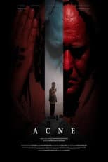 Poster for Acne