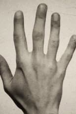 Poster for Fifth Metacarpal