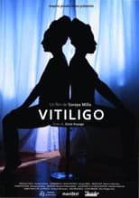 Poster for Vitiligo