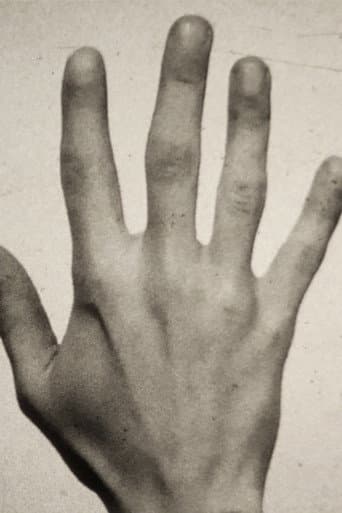 Poster for Fifth Metacarpal